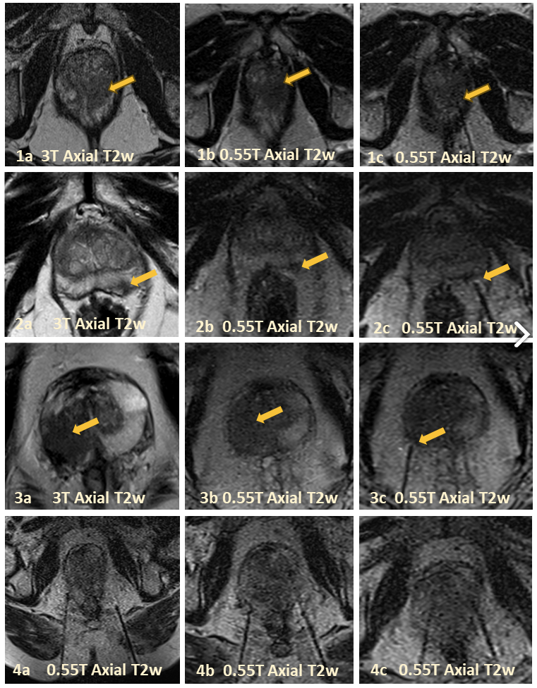 2025 ISMRM Summa Cum Laude Merit Award to Tejinder Kaur